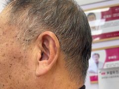 -声望听力助听器(东方路店)