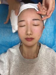 体验后-圣嘉新医疗美容医院