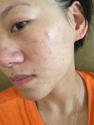 -露德瑪麗科技美肤·美迪迈·华熙生物