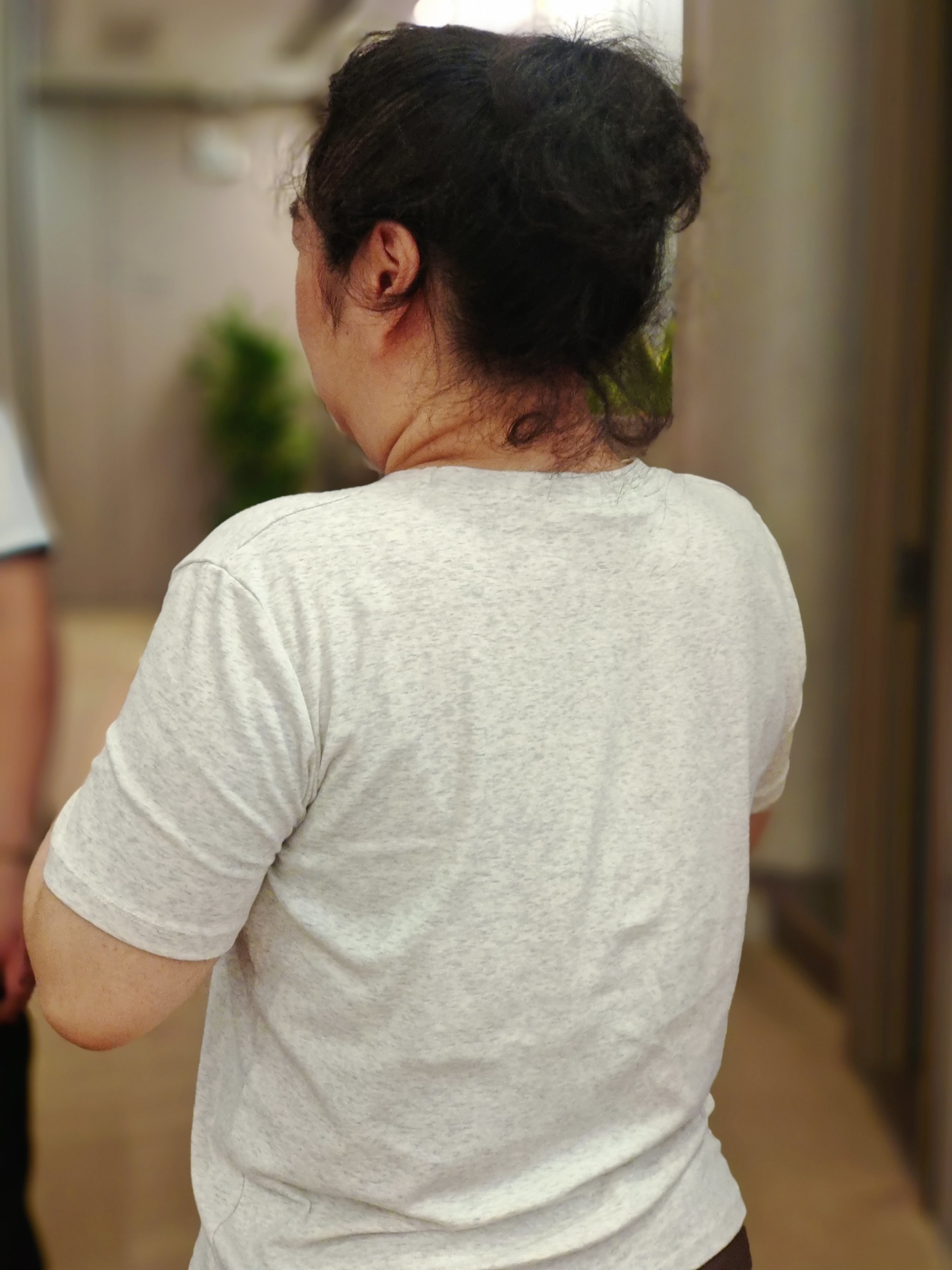 调理圆肩驼背,富贵包