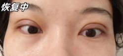-素美医疗美容·西南眼鼻整形·修复基地