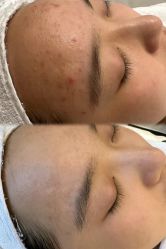 -美愈美肤MEIYU SKIN