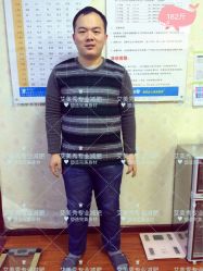 -维纳斯专业减肥