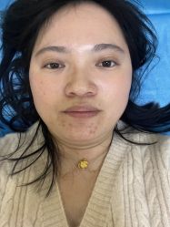 -伊丽莎白医疗美容