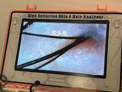 -舒欣头疗·俏丝谧语 白发脱发专业护理 