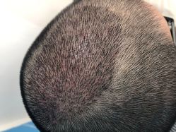 -雍禾植发全国连锁