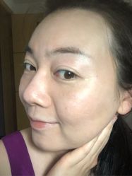 体验前-紫洁俪方（北京）医疗美容