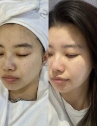 点击看大图 -SKIN79皮肤管理中心