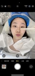 -BR光电保养