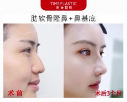 -上海时光整形外科医院