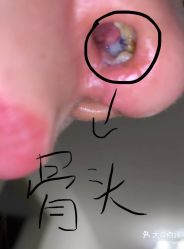 -八大处整形