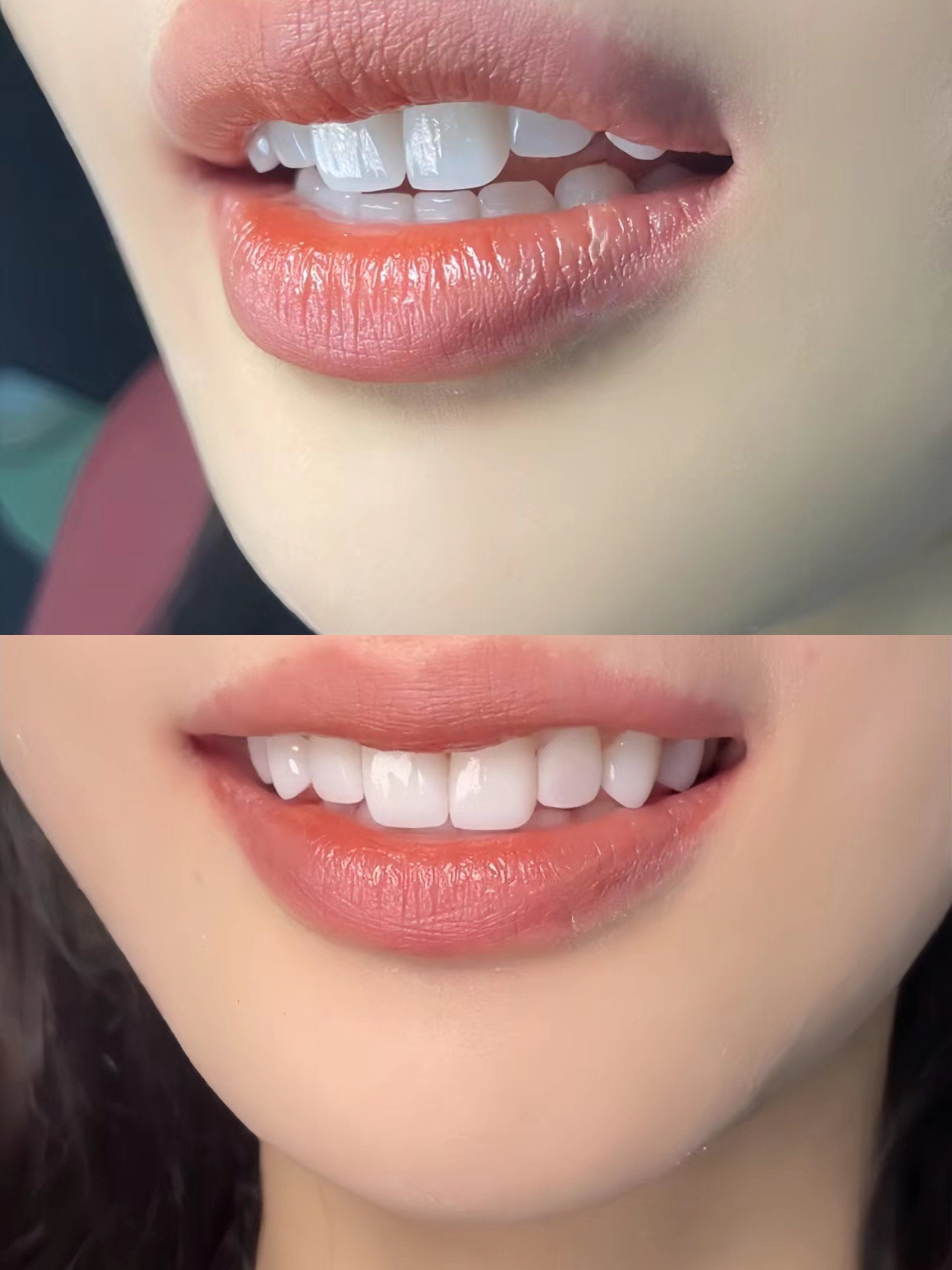 终于成为唇红齿白的大美女啦😄