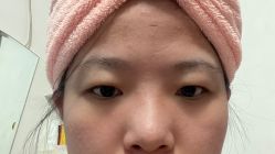 体验前-西安伊美尔医疗美容医院