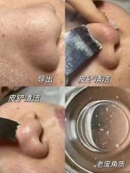 -LUNA皮相美·骨相美高级美感