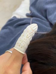 -瑶芳清颜草本祛痘