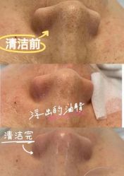 -SKIN79皮肤管理中心