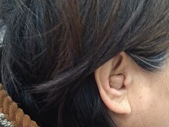 -自然之声助听器·呼吸机(兰考店)