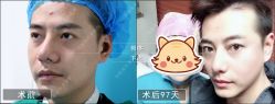 -北京丽星翼美医疗美容