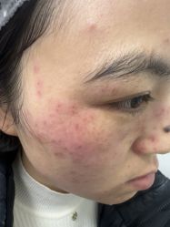 -长沙雅美医疗美容医院