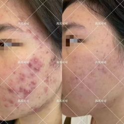 -薇薇安花系SPA