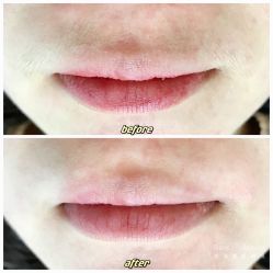 -植蔻妍倍儿专业脱毛·皮肤管理