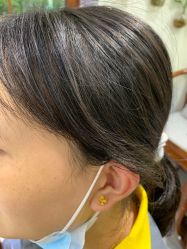 -痣斑堂·取大痣