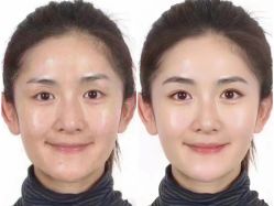 -倩极·精研痘敏肌管理