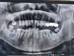 -牙博士口腔品牌连锁(杨浦店)