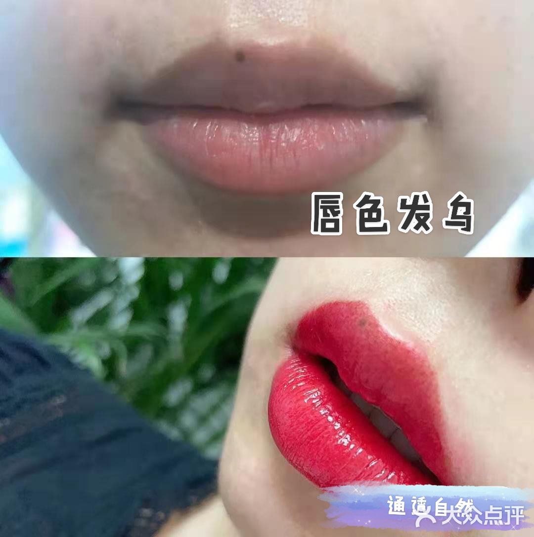 纹唇前后对比胜利太喜欢了加油