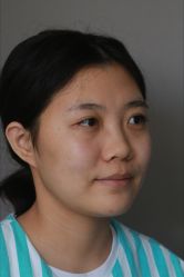 体验前-北京米扬丽格医疗美容·联合丽格鼻整形中心