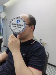 -唐风采假发补发定制