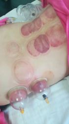 -亮丽妈妈·催乳通乳·产后恢复(万达店)