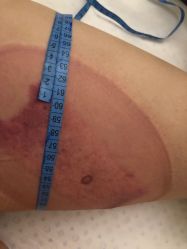 -肥三针腧穴瘦身馆