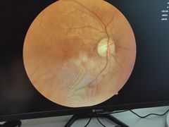 -宝岛眼镜(苏州浒关店)