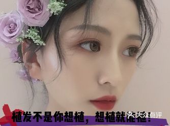 植发不是你想植，想植就能植！