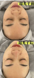 -LUNA皮相美·骨相美高级美感