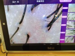 -森林头疗美容养发馆