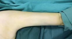 -东莞西妃整形美容医院