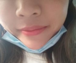 体验前-美瑞莎创美医疗美容