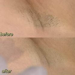 -植蔻妍倍儿专业脱毛·皮肤管理