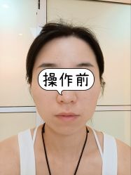 -北京爱育华医院-医疗美容科