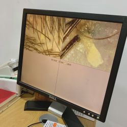 -章光101防脱养发荟