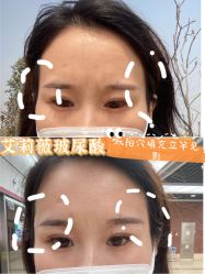 -新美荟医美·专注面部美学抗衰