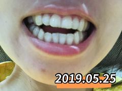 -齐玉齿科JADENTAL