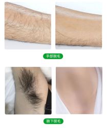 -HEYAN荷妍专业脱毛连锁机构