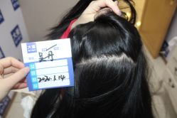 -大麦微针植发丨全国连锁