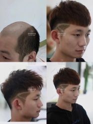 -发饰美男士增发补发假发定制店