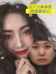 -北京米扬丽格医疗美容·联合丽格鼻整形中心