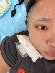 体验后-澳尔颜选医疗美容