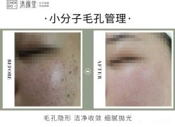 -清颜堂丨分子祛痘·功效美肤